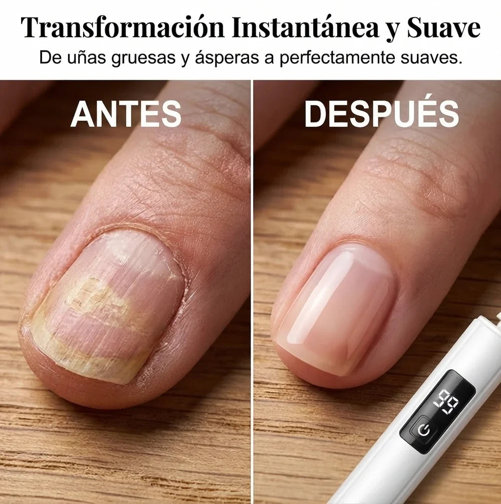 Pulidor Eléctrico Profesional para Uñas – Manicura Perfecta, Rápida y Fácil en Casa 💎